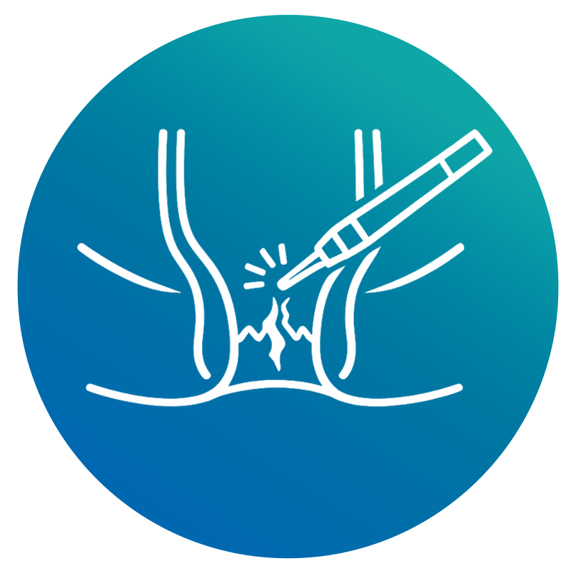 Small Incisions