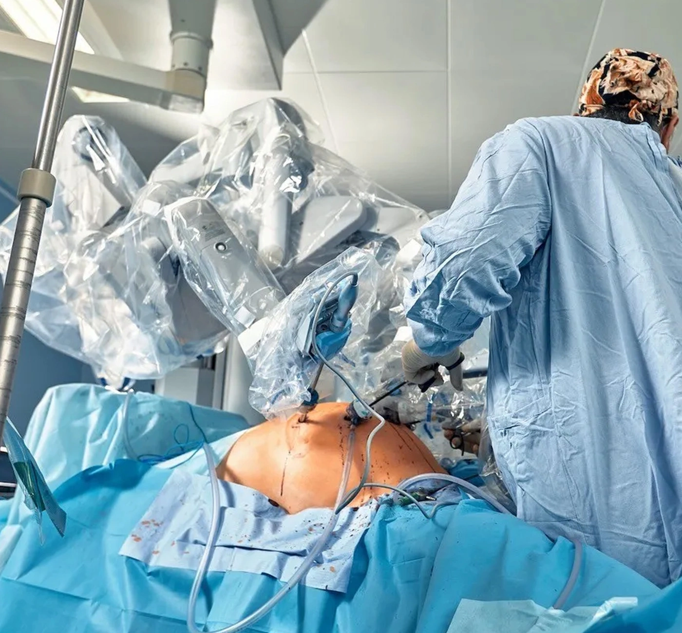 Robotic Hernia Surgery