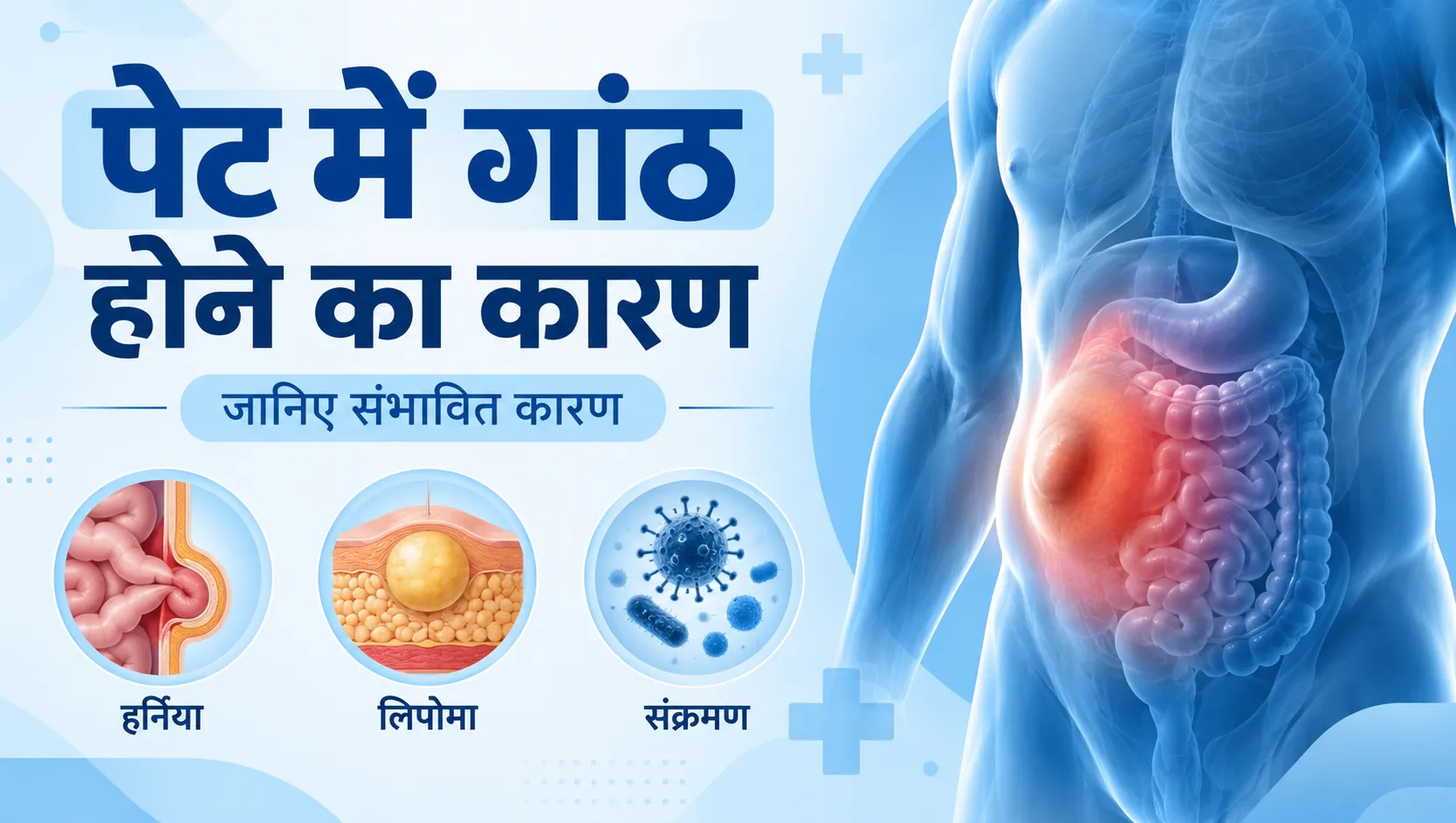 पेट में गांठ होने के कारण क्या हैं?