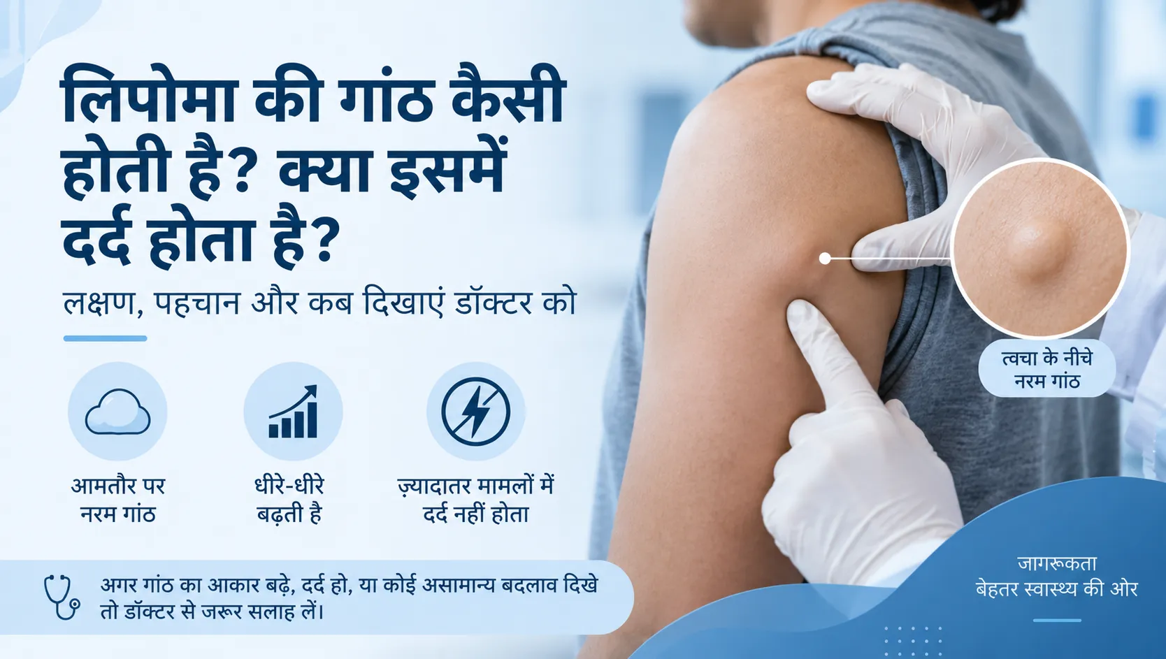 लिपोमा की गांठ कैसी होती है?