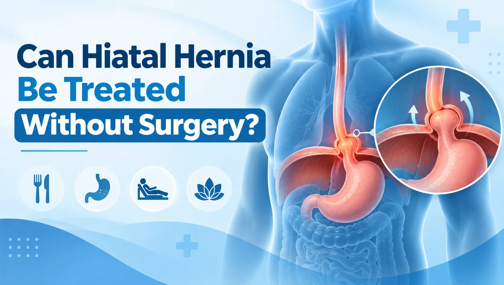 Can Hiatal Hernia Be Treated Without Surgery