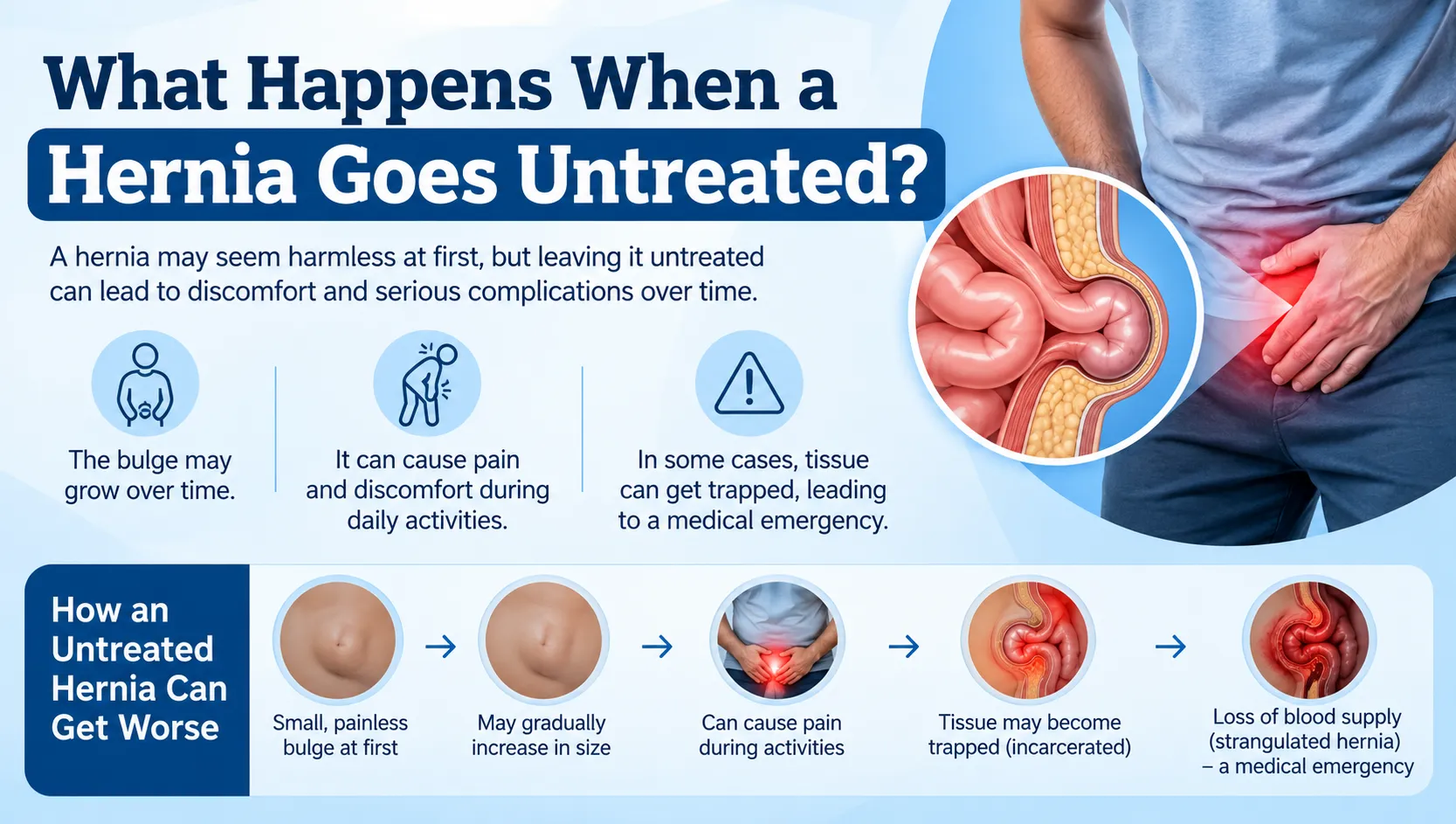 What Happens When a Hernia Goes Untreated